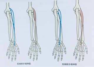 整体ストレッチ　肘外側痛２